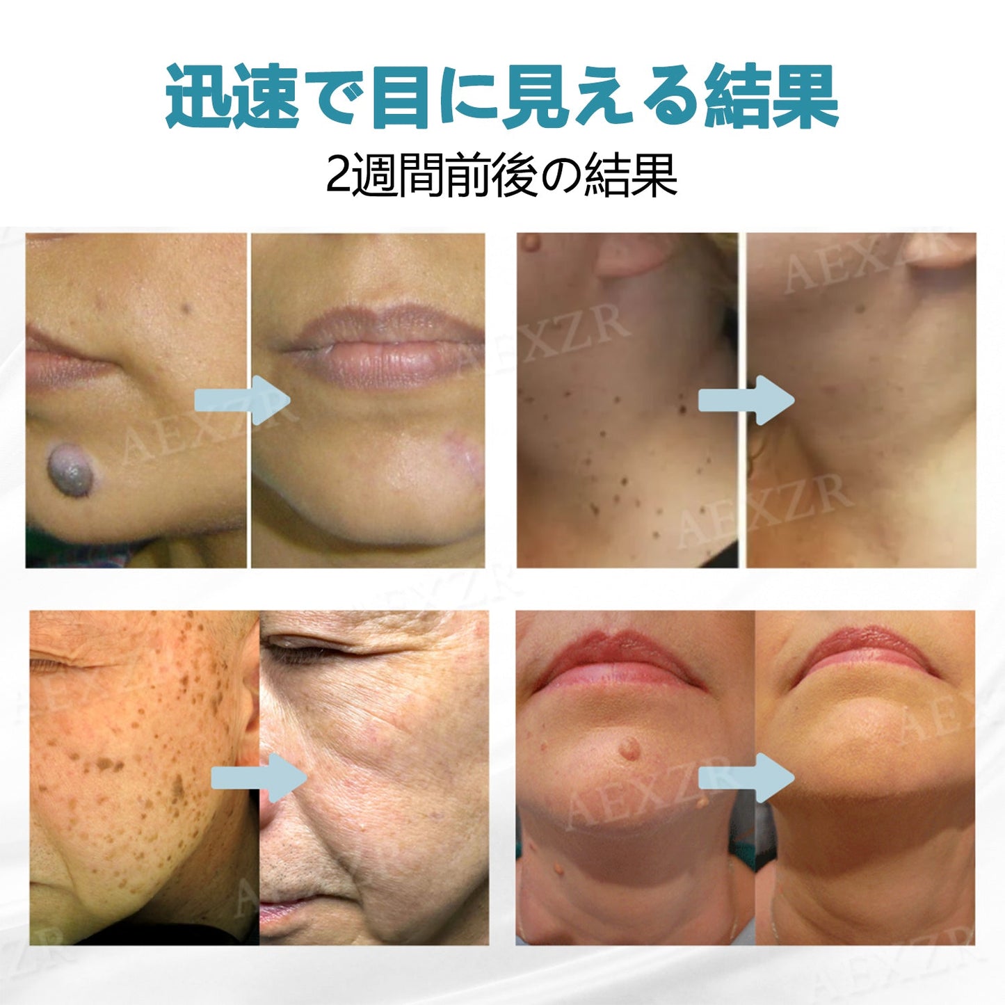 ð Bikenda® é䟵襲åã¬ãŒã¶ãŒãã³ èªå®
ã§å®å
šã«ã·ãã»ã€ããé€å»ã§ããææ°ã¢ã€ãã ïŒ