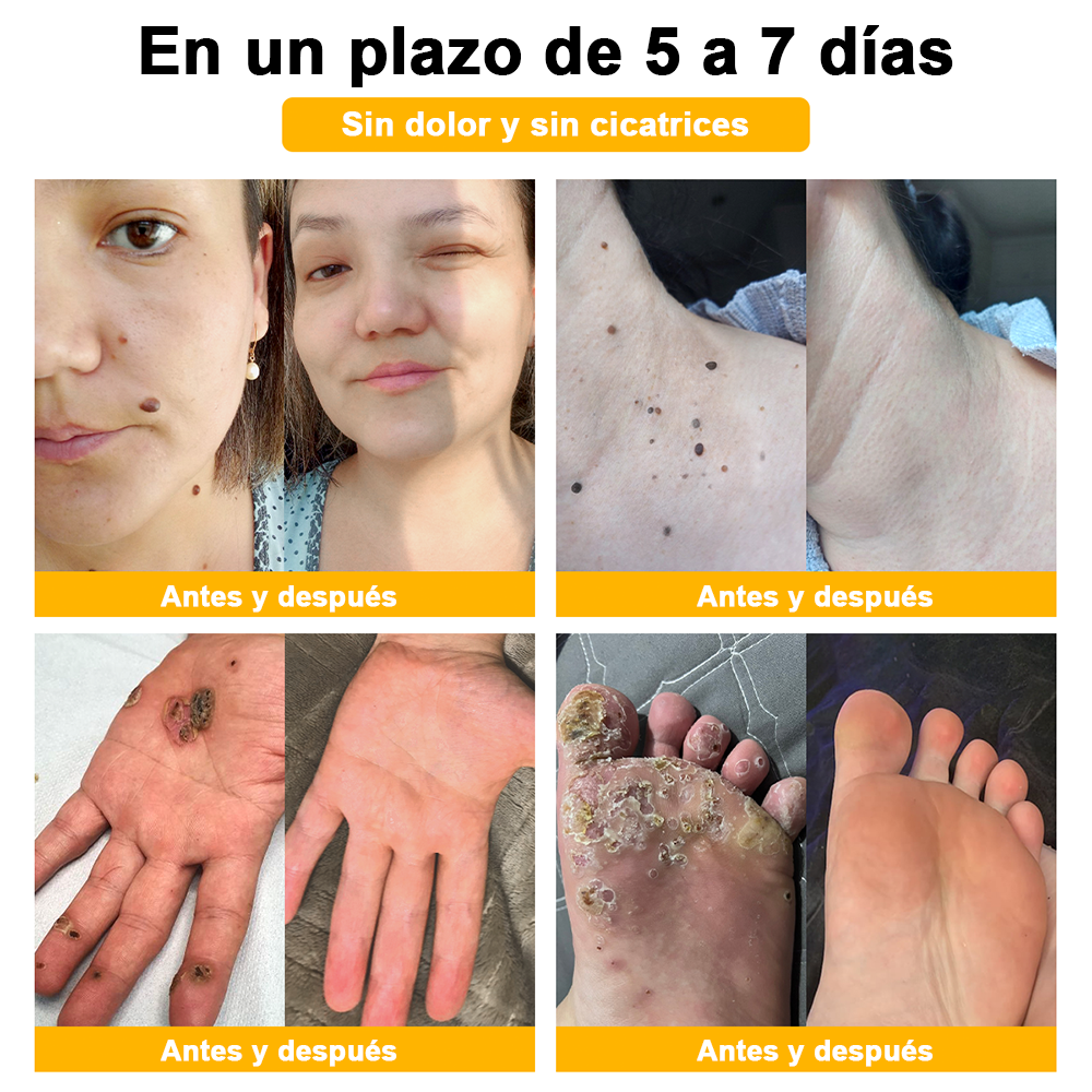 ðºðž ã¢ã¡ãªã«è£œã®å®å¿å質ð ð»ððððð⢠ããŒããã é
åã¹ãã³ã±ã¢ã¯ãªãŒã ã¯ãã¢ã¡ãªã«ç®èç§åŠäŒïŒAADïŒã«æšå¥šãããå®å掟ã¢ã€ãã ã§ã