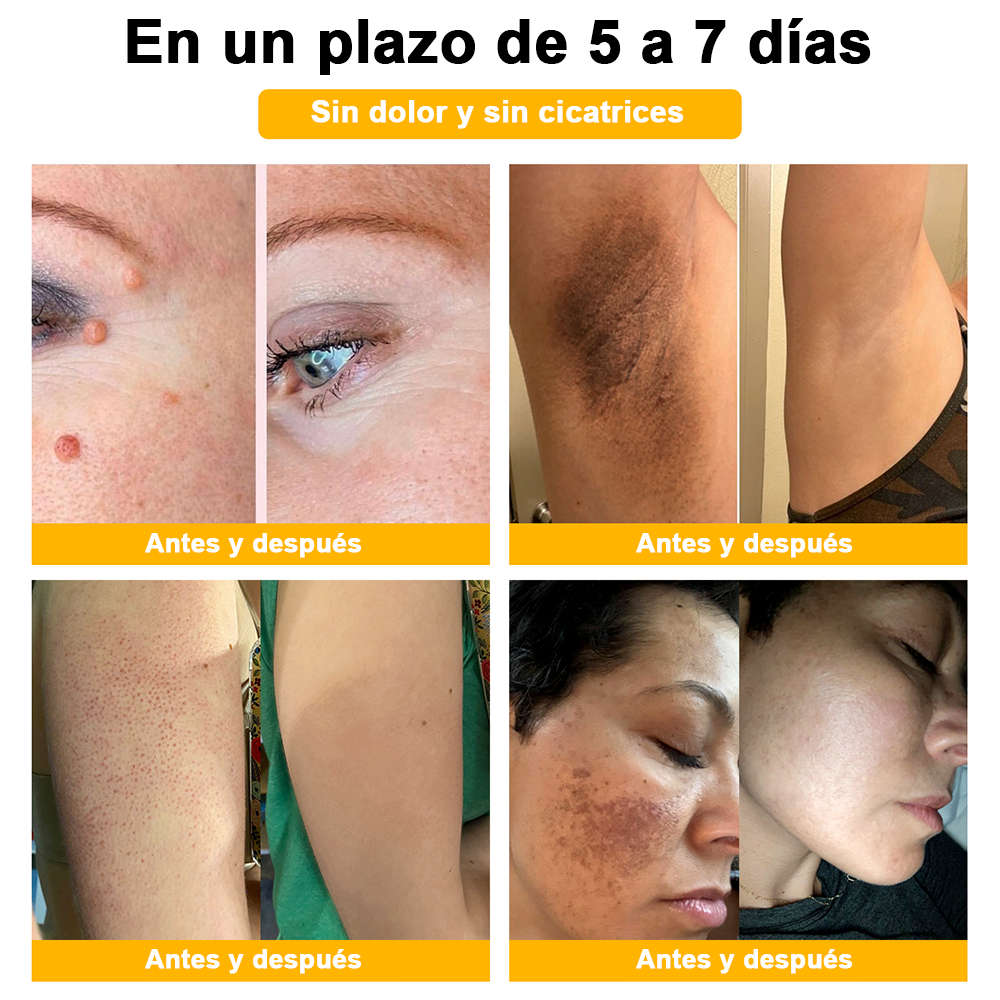 ðºðž ã¢ã¡ãªã«è£œã®å®å¿å質ð ð»ððððð⢠ããŒããã é
åã¹ãã³ã±ã¢ã¯ãªãŒã ã¯ãã¢ã¡ãªã«ç®èç§åŠäŒïŒAADïŒã«æšå¥šãããå®å掟ã¢ã€ãã ã§ã