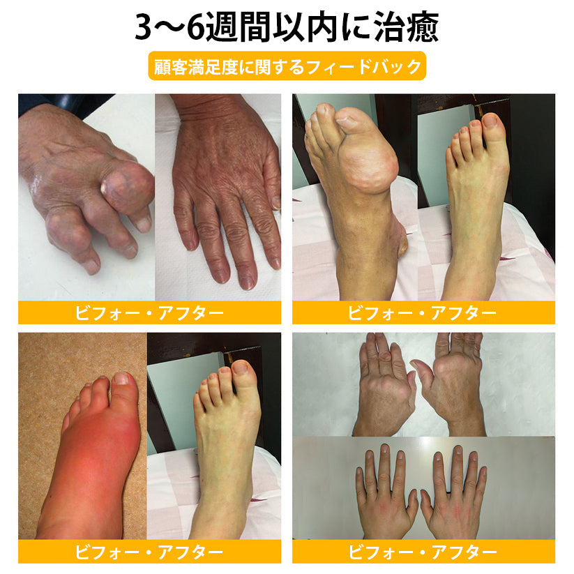 公式ストア:TLOPA® ボツリヌス毒素＆ビーベノム鎮痛骨治癒クリーム🌞オーストラリア整形外科協会（AOA）認定🔴