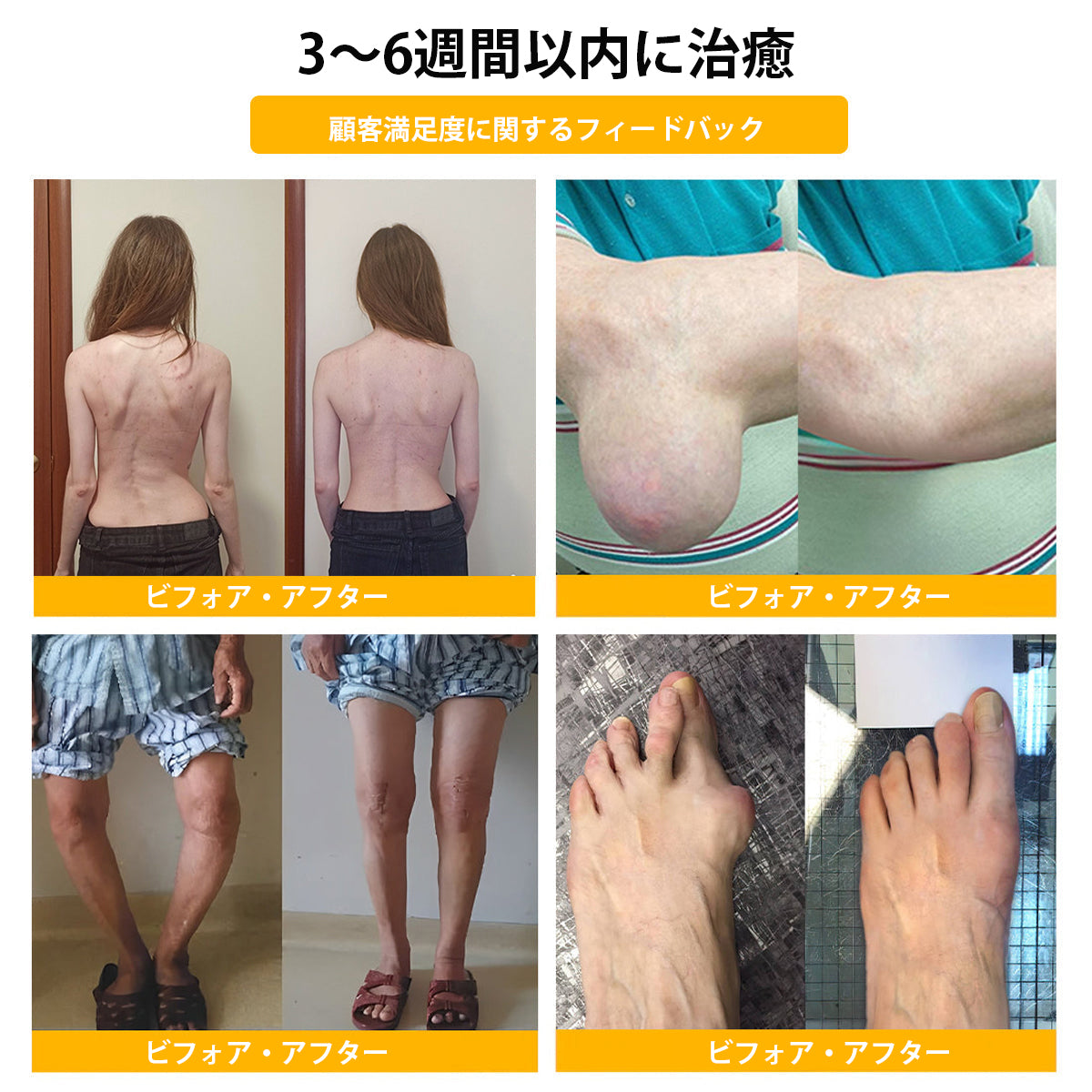 公式ストア:TLOPA® ボツリヌス毒素＆ビーベノム鎮痛骨治癒クリーム🌞オーストラリア整形外科協会（AOA）認定🔴