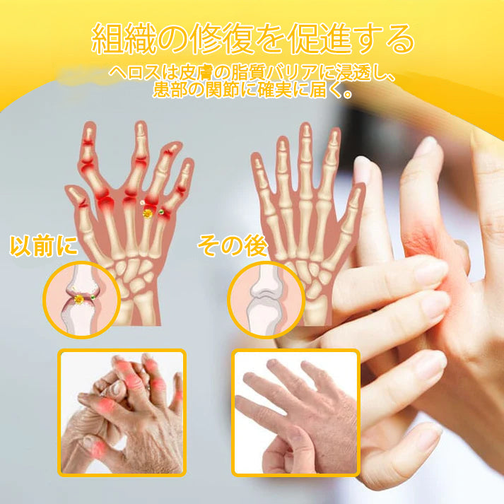 公式ストア:TLOPA® ボツリヌス毒素＆ビーベノム鎮痛骨治癒クリーム🌞オーストラリア整形外科協会（AOA）認定🔴