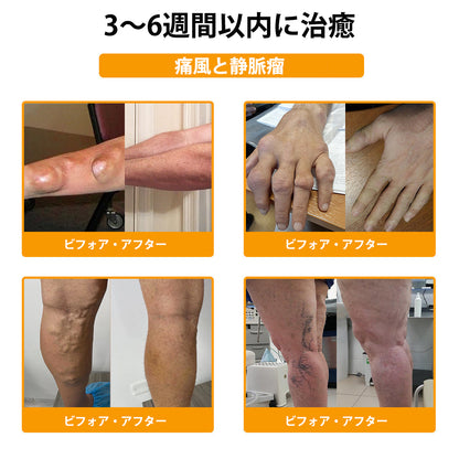 公式ストア:TLOPA® ボツリヌス毒素＆ビーベノム鎮痛骨治癒クリーム🌞オーストラリア整形外科協会（AOA）認定🔴