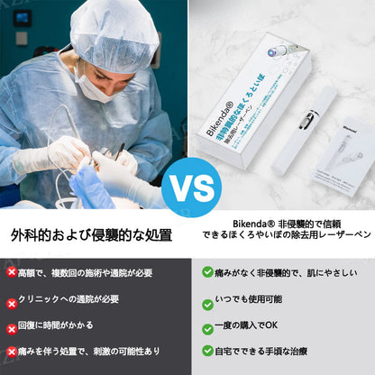 💎 Bikenda® 非侵襲型レーザーペン 自宅で安全にシミ・イボを除去できる最新アイテム！