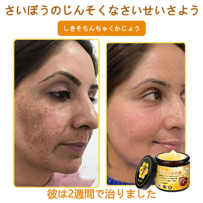 アメリカ製✨VLSVLS® 蜂毒リニューアルクリーム – 本日最終日！80％オフのチャンスをお見逃しなく！🐝