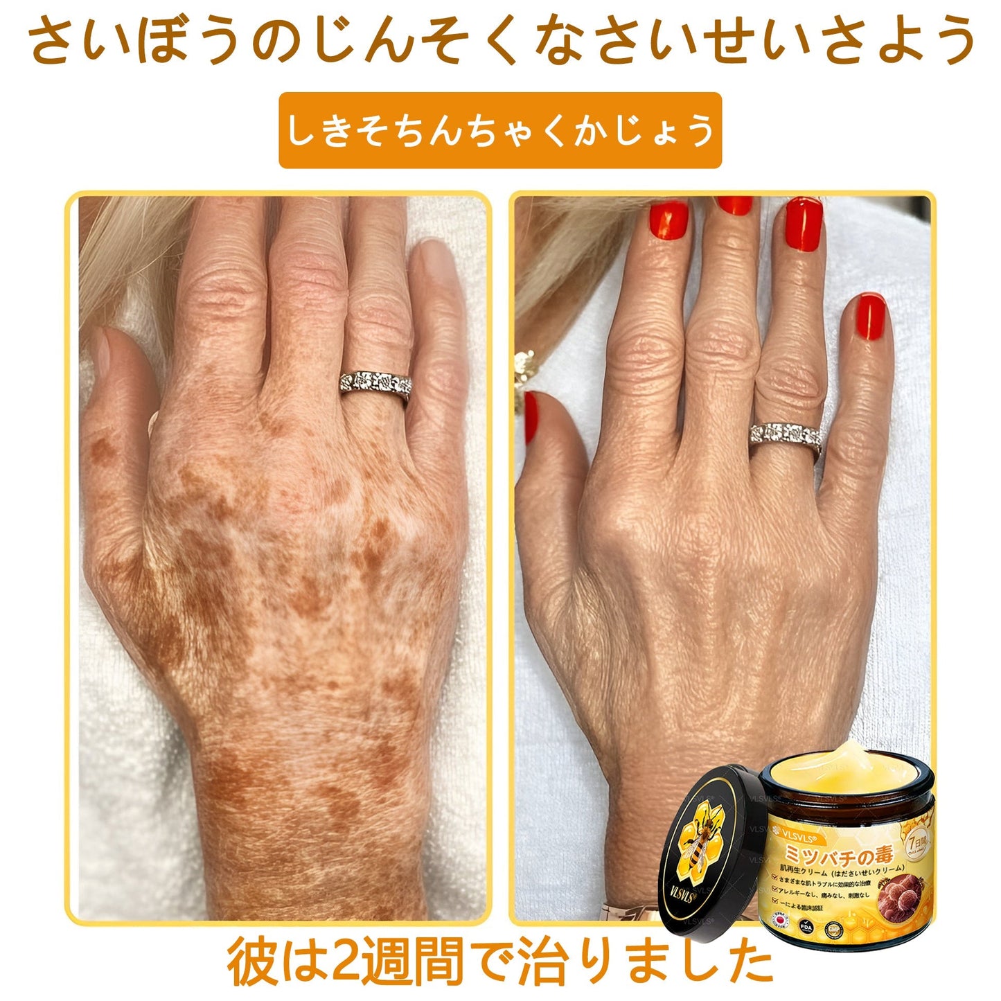 アメリカ製✨VLSVLS® 蜂毒リニューアルクリーム – 本日最終日！80％オフのチャンスをお見逃しなく！🐝