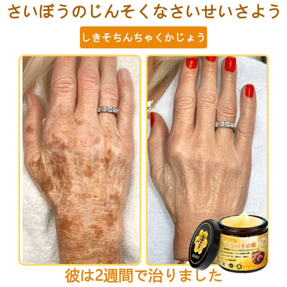 アメリカ製✨VLSVLS® 蜂毒リニューアルクリーム – 本日最終日！80％オフのチャンスをお見逃しなく！🐝