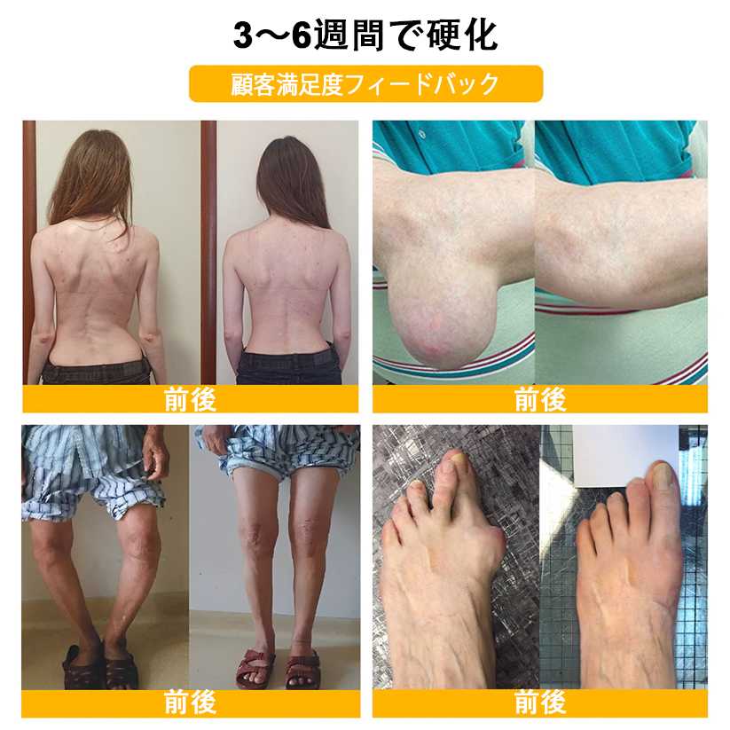 🔥🔥TLOPA®ボツリヌストキシンとビーベノムの骨の痛みを和らげ、癒すバーム🐝（整形外科医がシニアに推奨）🟡⚪