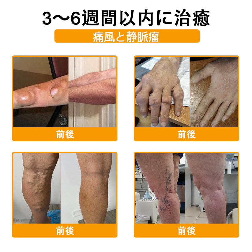 🔥🔥TLOPA®ボツリヌストキシンとビーベノムの骨の痛みを和らげ、癒すバーム🐝（整形外科医がシニアに推奨）🟡⚪
