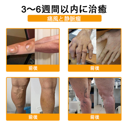 🔥🔥TLOPA®ボツリヌストキシンとビーベノムの骨の痛みを和らげ、癒すバーム🐝（整形外科医がシニアに推奨）🟡⚪