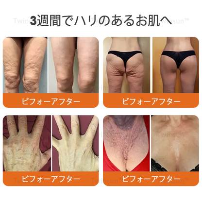 ✨Twinsun™ ボトックス×蜂毒配合の引き締め美容スティックが新登場！🔥本日限定！70％OFFの最終セール開催中！
