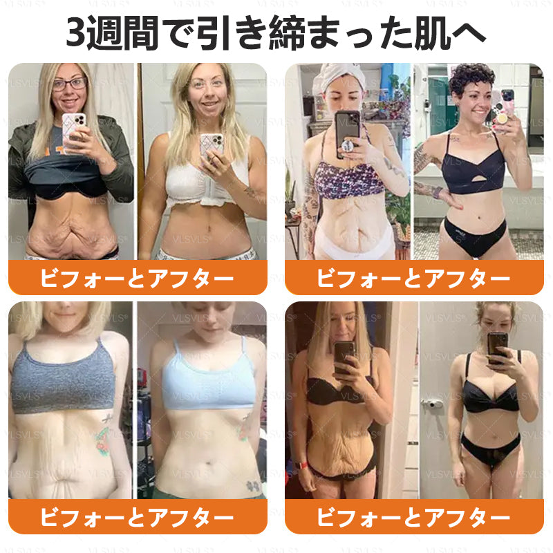 アメリカ製✨VLSVLS® 蜂毒リニューアルクリーム – 本日最終日！80％オフのチャンスをお見逃しなく！🐝