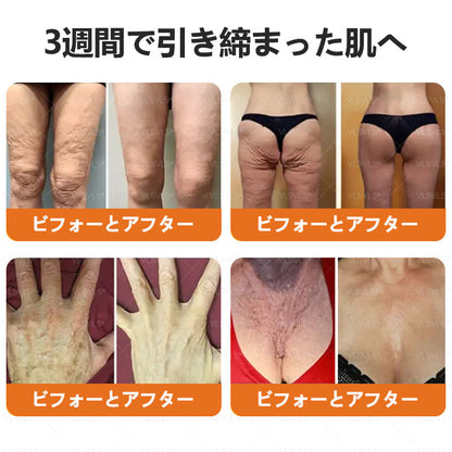 アメリカ製✨VLSVLS® 蜂毒リニューアルクリーム – 本日最終日！80％オフのチャンスをお見逃しなく！🐝