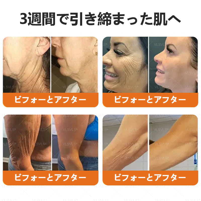 アメリカ製✨VLSVLS® 蜂毒リニューアルクリーム – 本日最終日！80％オフのチャンスをお見逃しなく！🐝