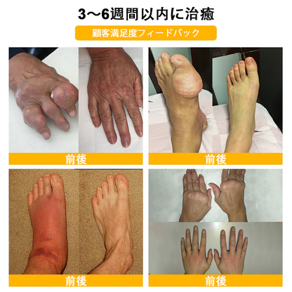 🔥🔥TLOPA®ボツリヌストキシンとビーベノムの骨の痛みを和らげ、癒すバーム🐝（整形外科医がシニアに推奨）🟡⚪