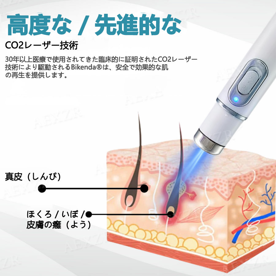 💎 Bikenda® 非侵襲型レーザーペン 自宅で安全にシミ・イボを除去できる最新アイテム！
