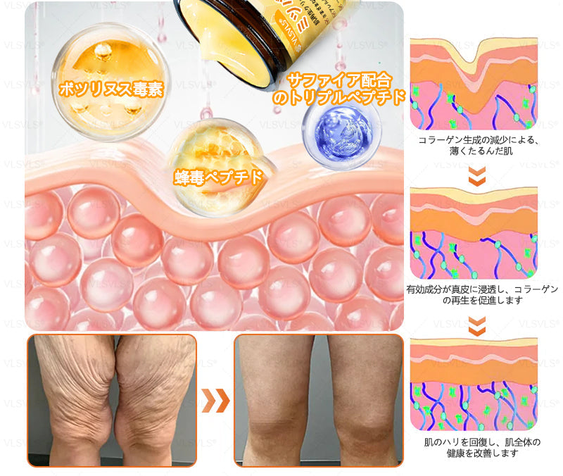 アメリカ製✨VLSVLS® 蜂毒リニューアルクリーム – 本日最終日！80％オフのチャンスをお見逃しなく！🐝