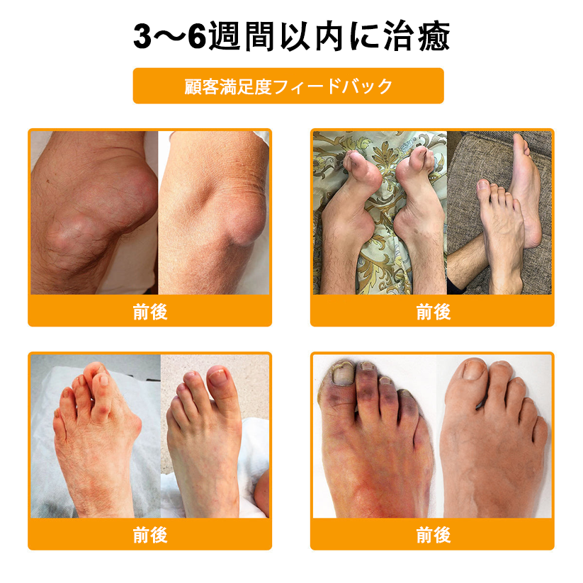 🔥🔥TLOPA®ボツリヌストキシンとビーベノムの骨の痛みを和らげ、癒すバーム🐝（整形外科医がシニアに推奨）🟡⚪
