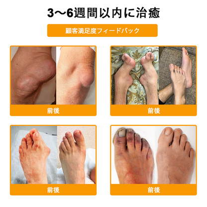 🔥🔥TLOPA®ボツリヌストキシンとビーベノムの骨の痛みを和らげ、癒すバーム🐝（整形外科医がシニアに推奨）🟡⚪